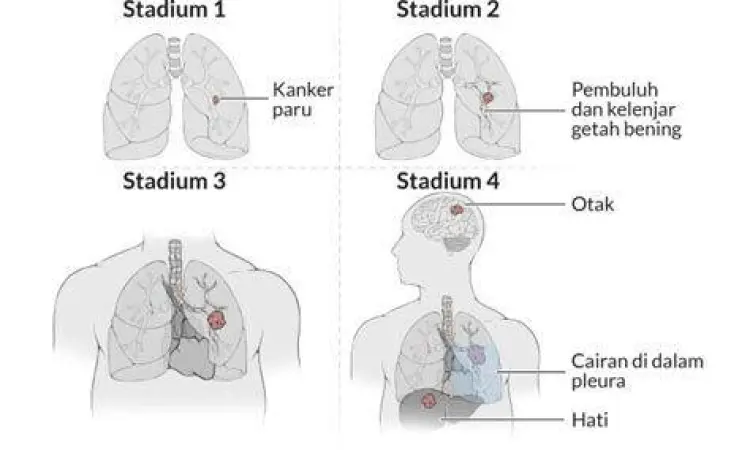 Ilustrasi paru-paru sehat dan gaya hidup bebas rokok