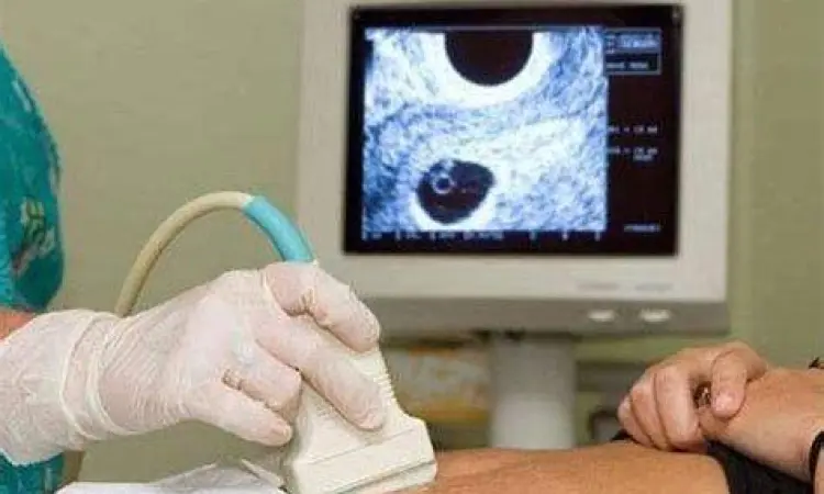 proses pemeriksaan USG pada ibu hamil muda