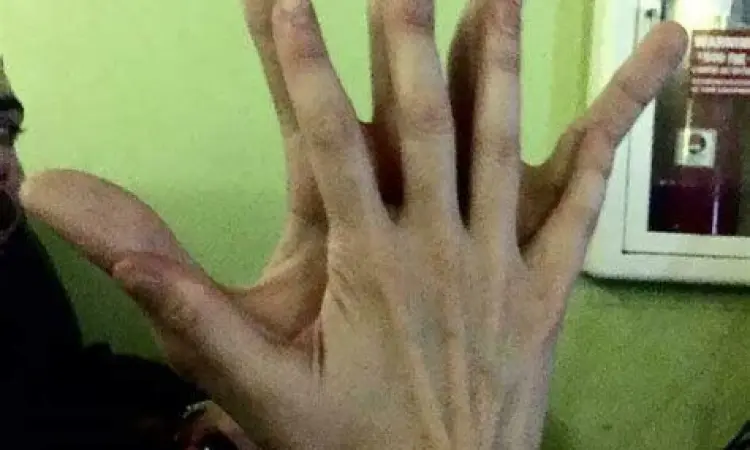 perbandingan berbagai ukuran tangan manusia